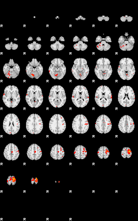 Patients 29282 191