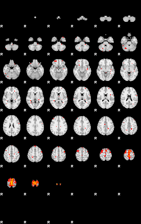 Patients 29283 120