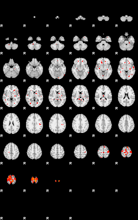 Patients 29287 197