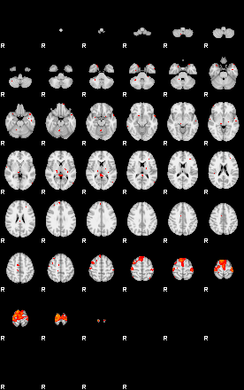 Patients 29289 122