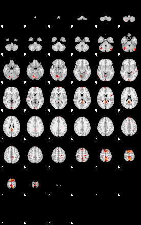 Patients 29389 200