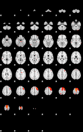 Patients 29412 184