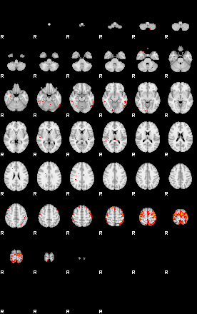 Patients 29417 133