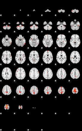 Patients 29543 17