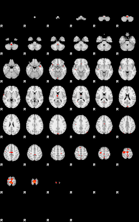 Patients 29732 125