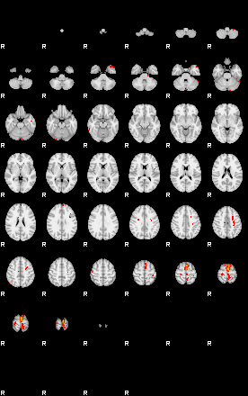 Patients 29743 199