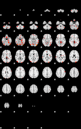 Patients 28817 172