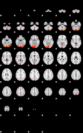 Patients 29013 80