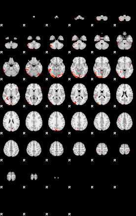 Patients 29013 85