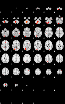 Patients 29017 200