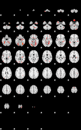 Patients 29029 162