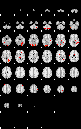 Patients 29052 83