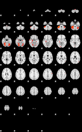 Patients 29062 148