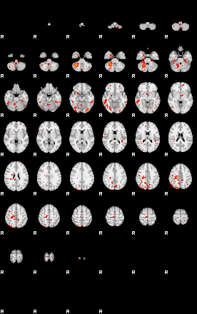 Patients 29097 84