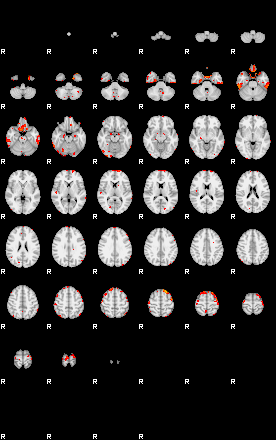 Patients 29114 152