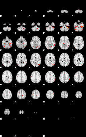 Patients 29183 86