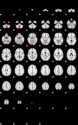 Patients 29207 92