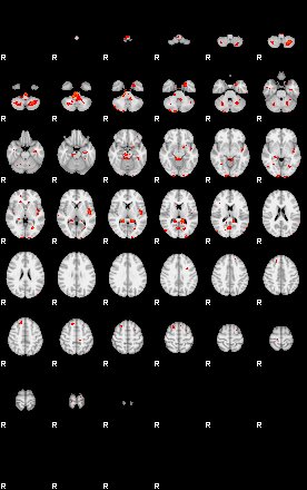 Patients 29278 10