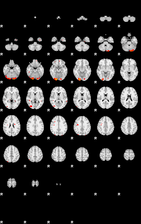 Patients 29389 75