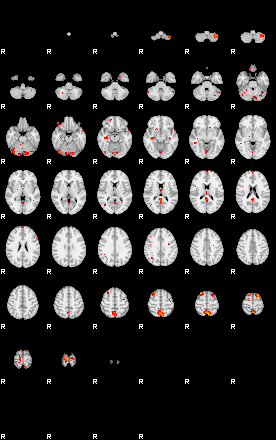 Patients 29393 17