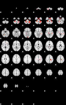 Patients 29416 96