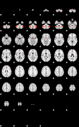 Patients 29539 159