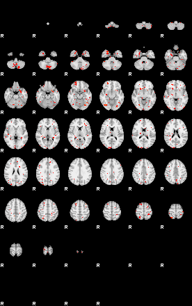 Patients 29603 174