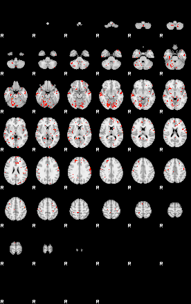 Patients 29615 99