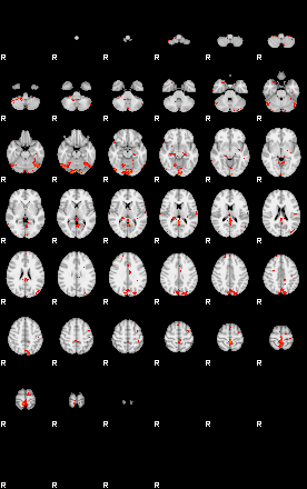 Patients 30005 60