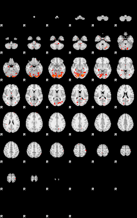 Patients 30018 75