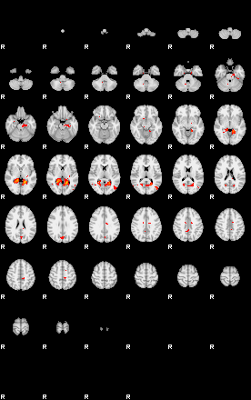 Patients 28718 81