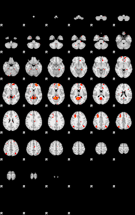 Patients 28791 94