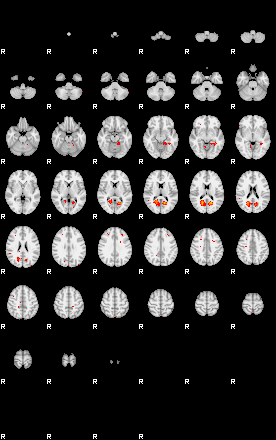 Patients 28906 26