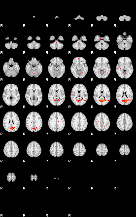 Patients 28941 26