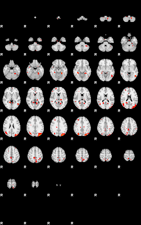 Patients 28949 2