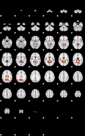 Patients 29012 77