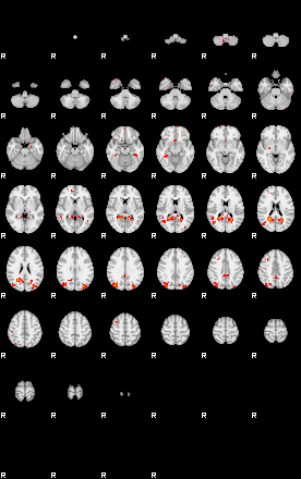 Patients 29015 2