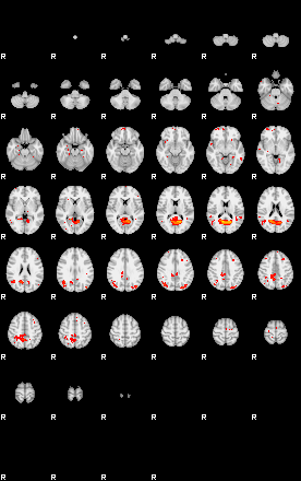 Patients 29041 24