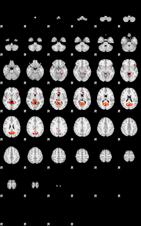 Patients 29060 23