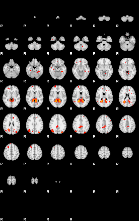 Patients 29109 2