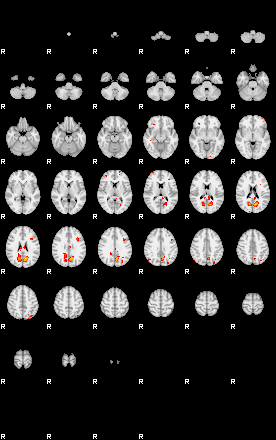 Patients 29109 23