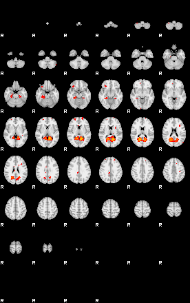 Patients 29111 24