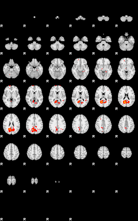 Patients 29112 24