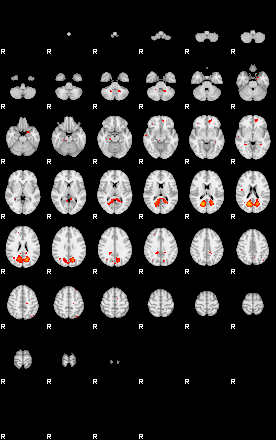 Patients 29113 24