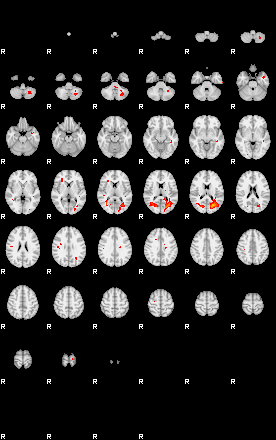 Patients 29115 132