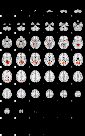 Patients 29163 25