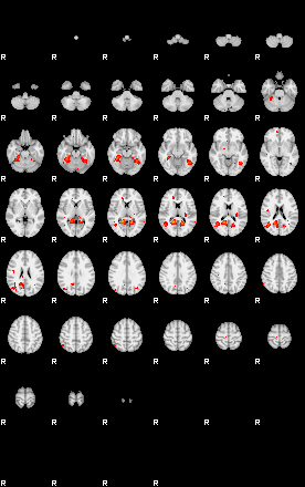 Patients 29164 25