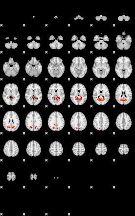 Patients 29165 25