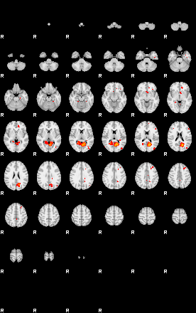 Patients 29167 30