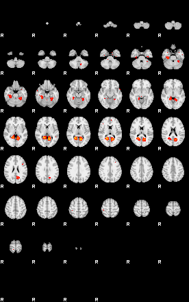 Patients 29173 28